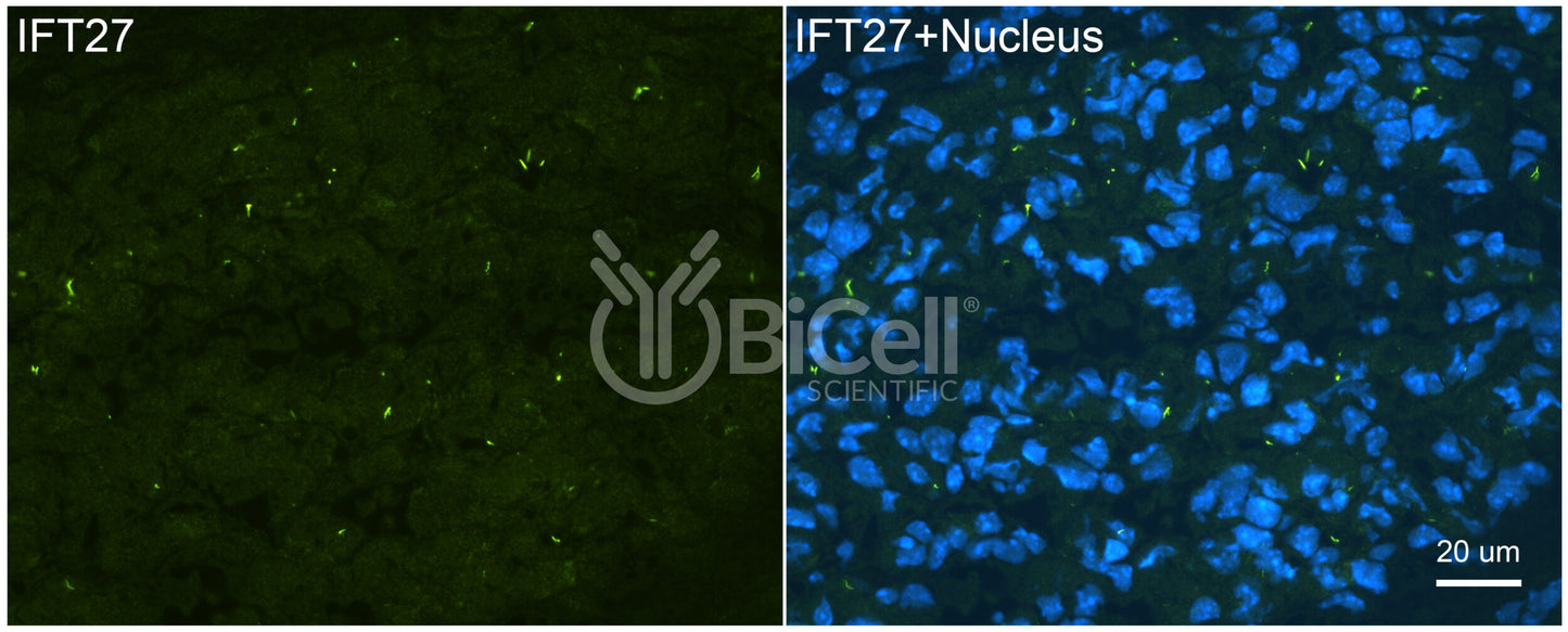 IFT27 (BBS19) Antibody - FFPE Validated
