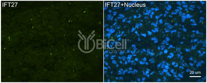 IFT27 (BBS19) Antibody - FFPE Validated