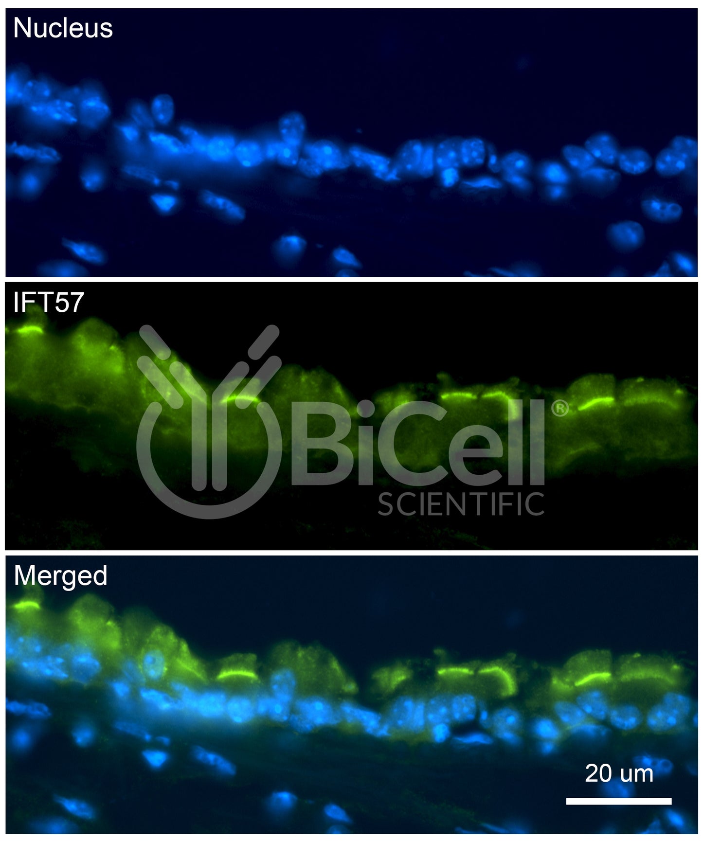 IFT57 Antibody