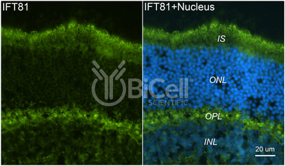 IFT81 Antibody