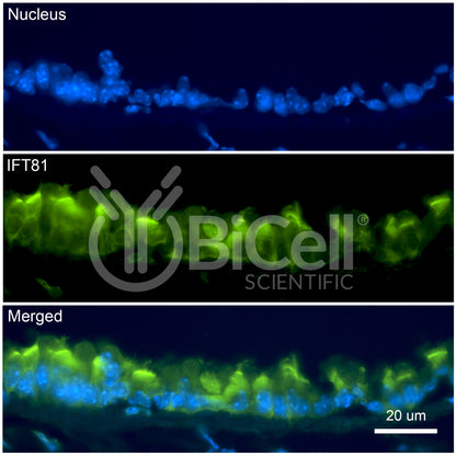 IFT81 Antibody - FFPE Validated