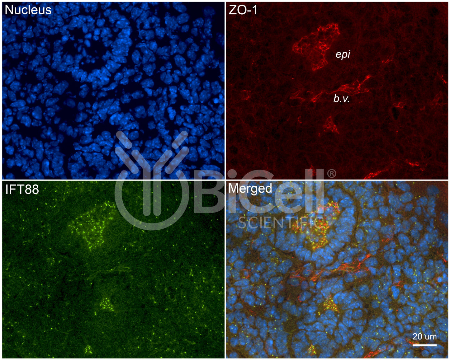 IFT88 Antibody - Western Blot Validated