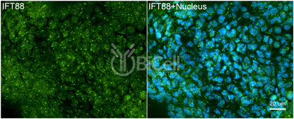 IFT88 Antibody - Western Blot Validated