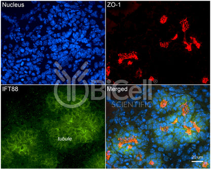 IFT88 Antibody - Western Blot Validated