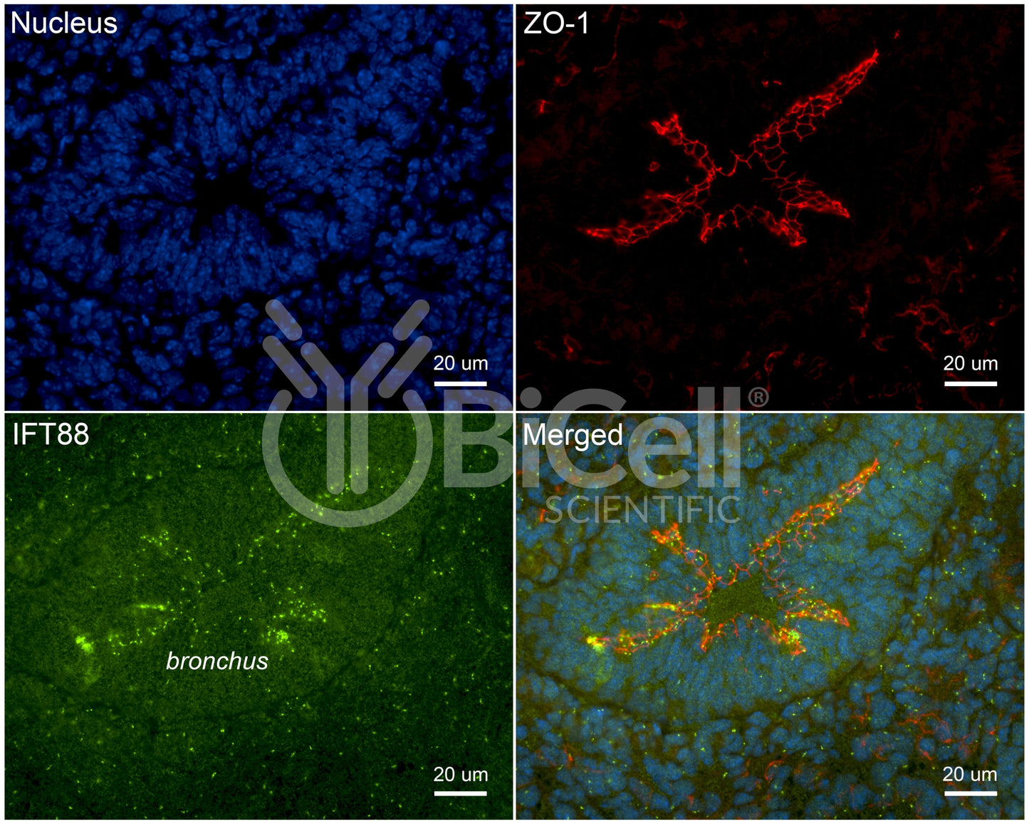 IFT88 Antibody - Western Blot Validated