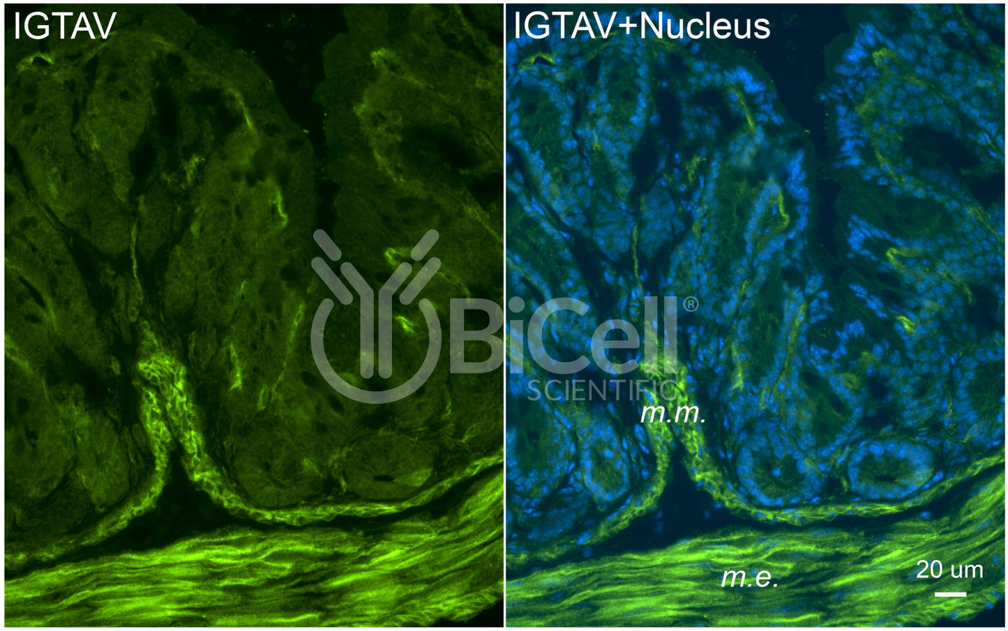 Integrin alpha-V (ITGAV or CD51) Antibody - Western Blot Validated