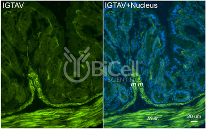 Integrin alpha-V (ITGAV or CD51) Antibody - FFPE Validated