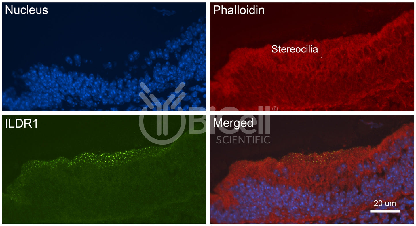 ILDR1 (Angulin-2) Antibody - FFPE Validated