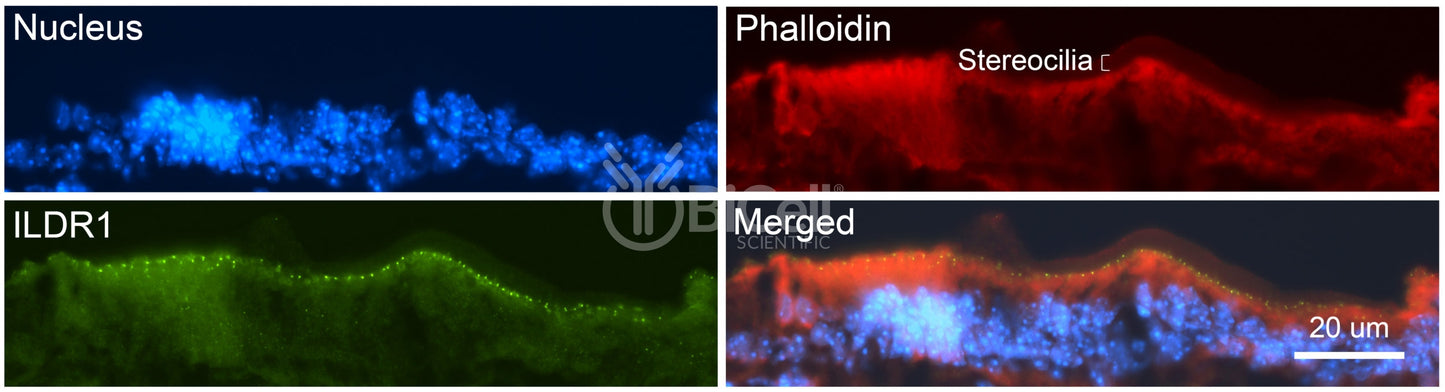 ILDR1 (Angulin-2) Antibody - FFPE Validated