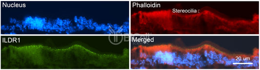 ILDR1 (Angulin-2) Antibody - FFPE Validated