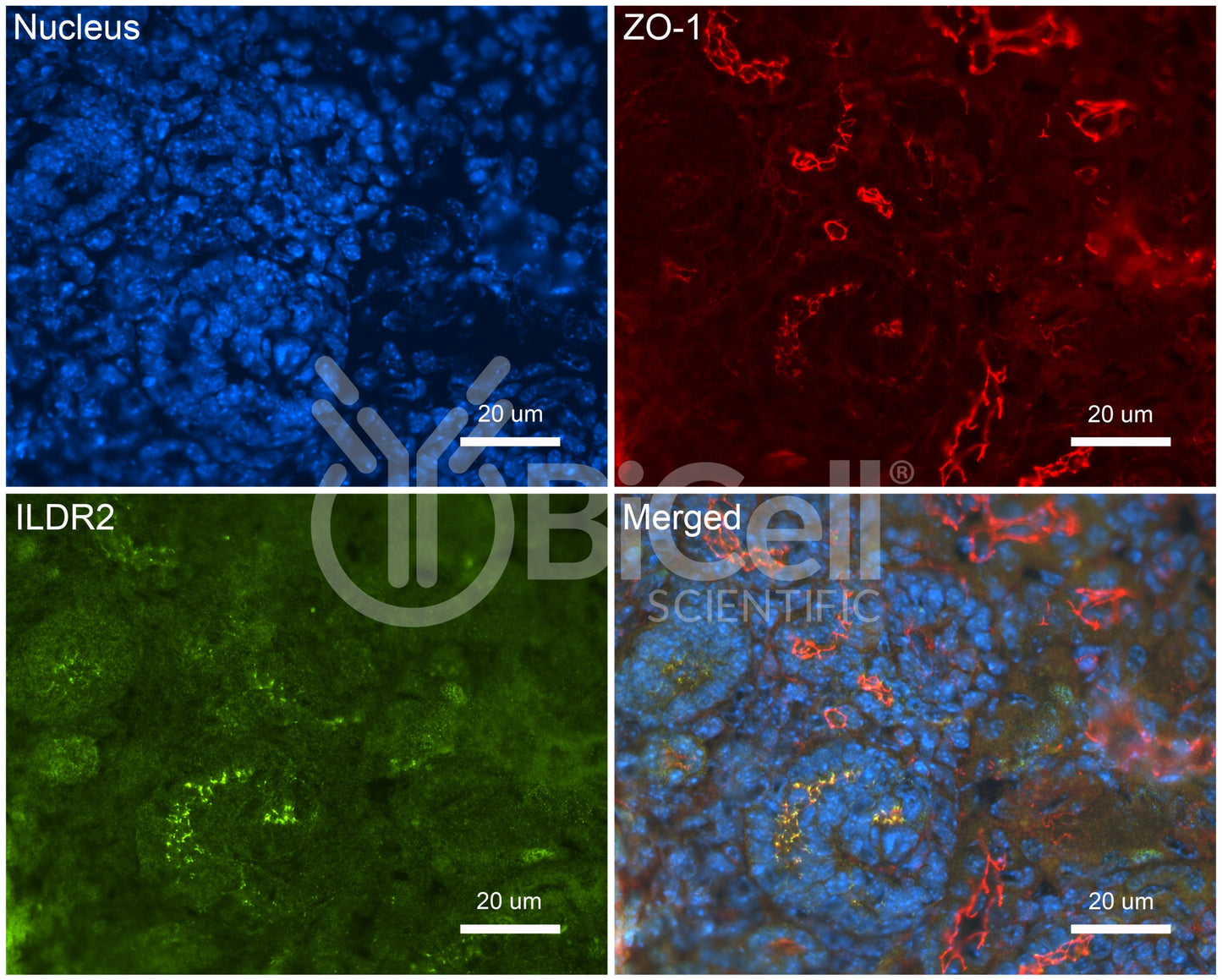ILDR2 (Angulin-3) Antibody - Western Blot Validated