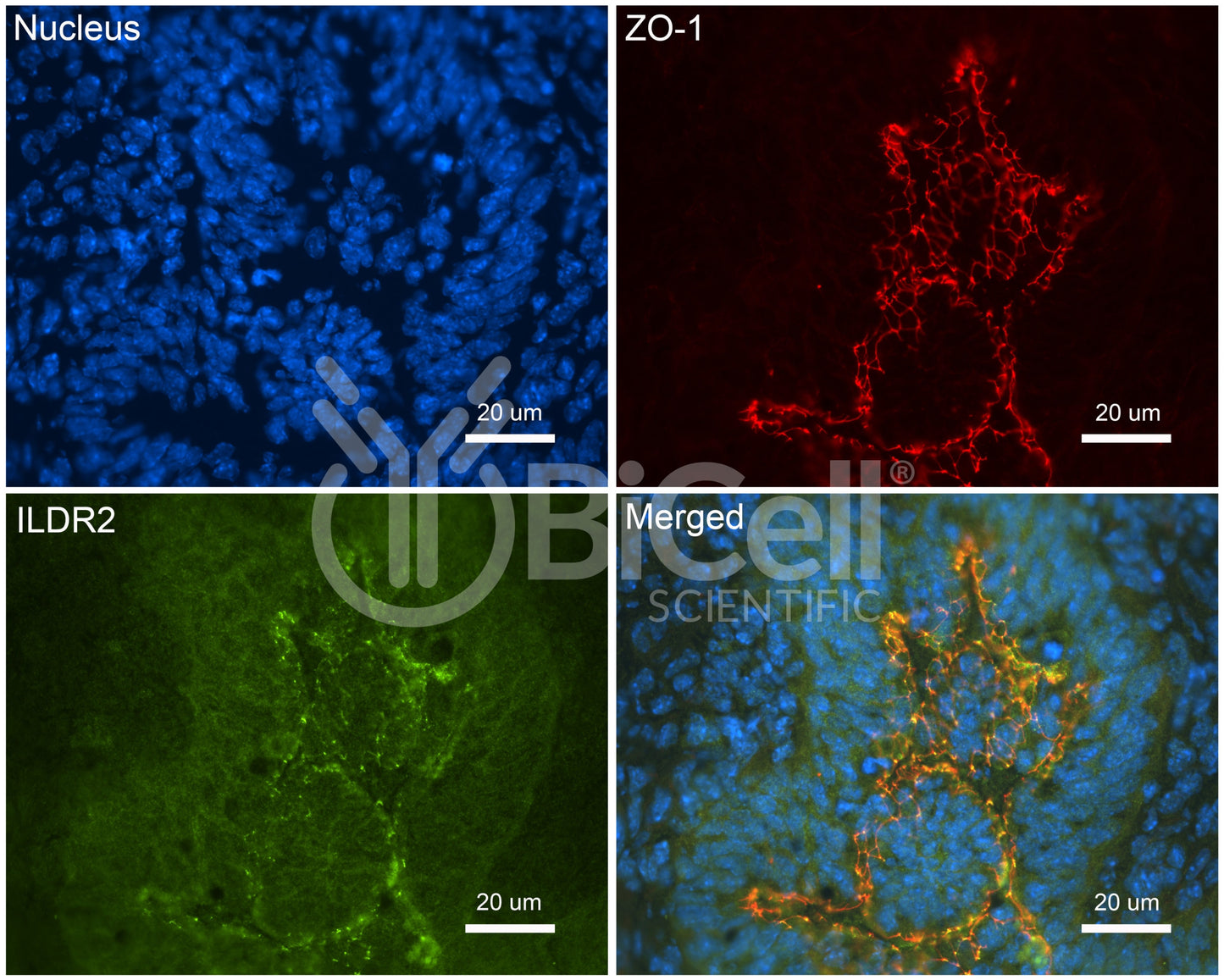 ILDR2 (Angulin-3) Antibody - Western Blot Validated