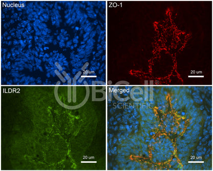 ILDR2 (Angulin-3) Antibody - Western Blot Validated