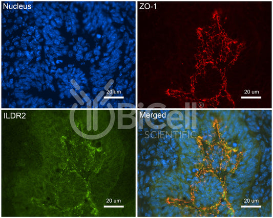 ILDR2 (Angulin-3) Antibody