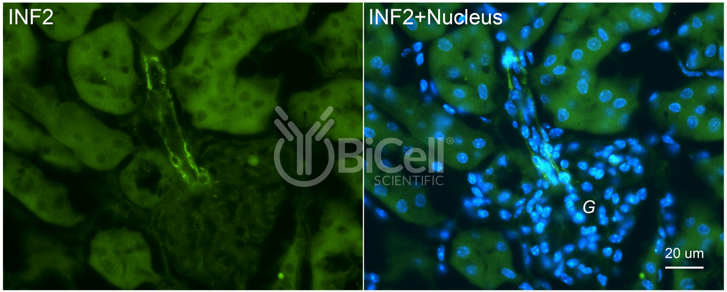 INF2 Antibody - Western Blot Validated