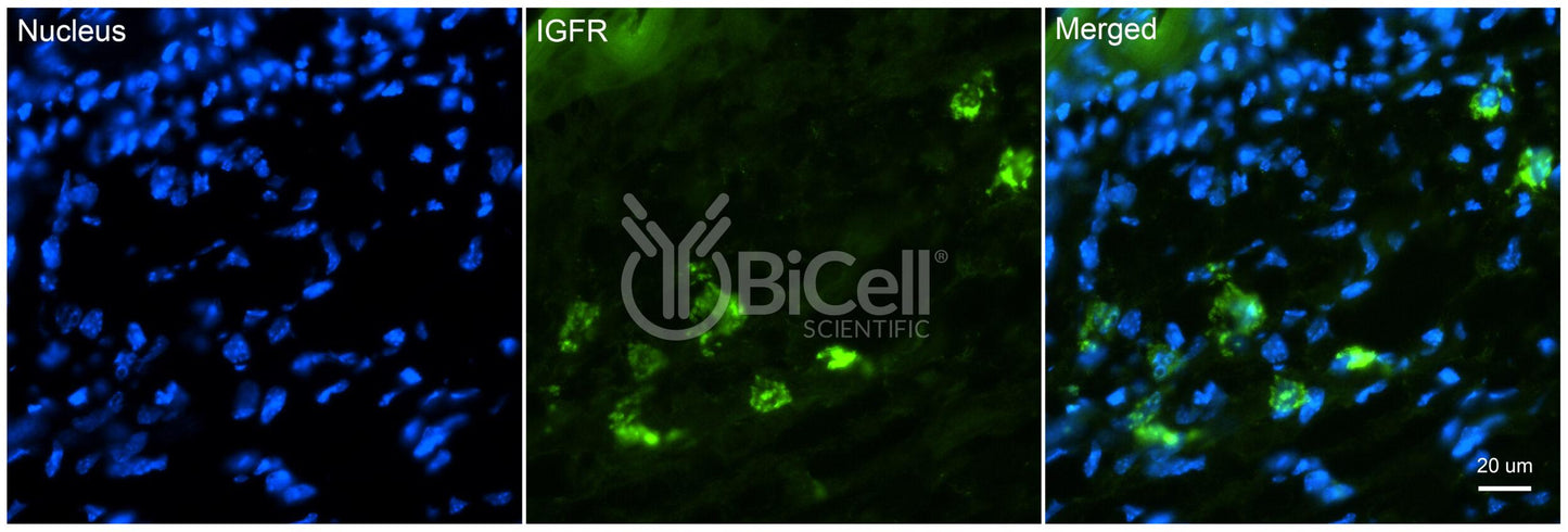 IGF1R (IGFR or CD221) Antibody - FFPE Validated