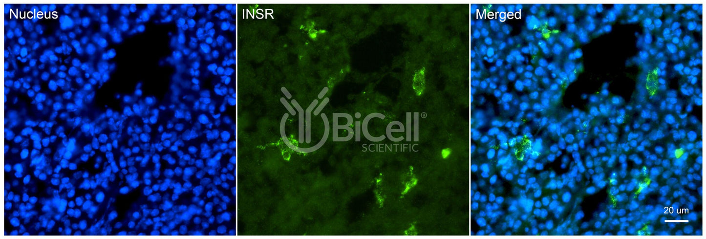 Insulin receptor (INSR or CD220) Antibody - FFPE Validated