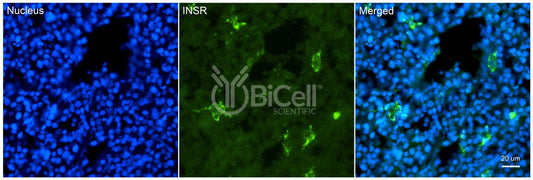 Insulin receptor (INSR or CD220) Antibody - Western Blot Validated