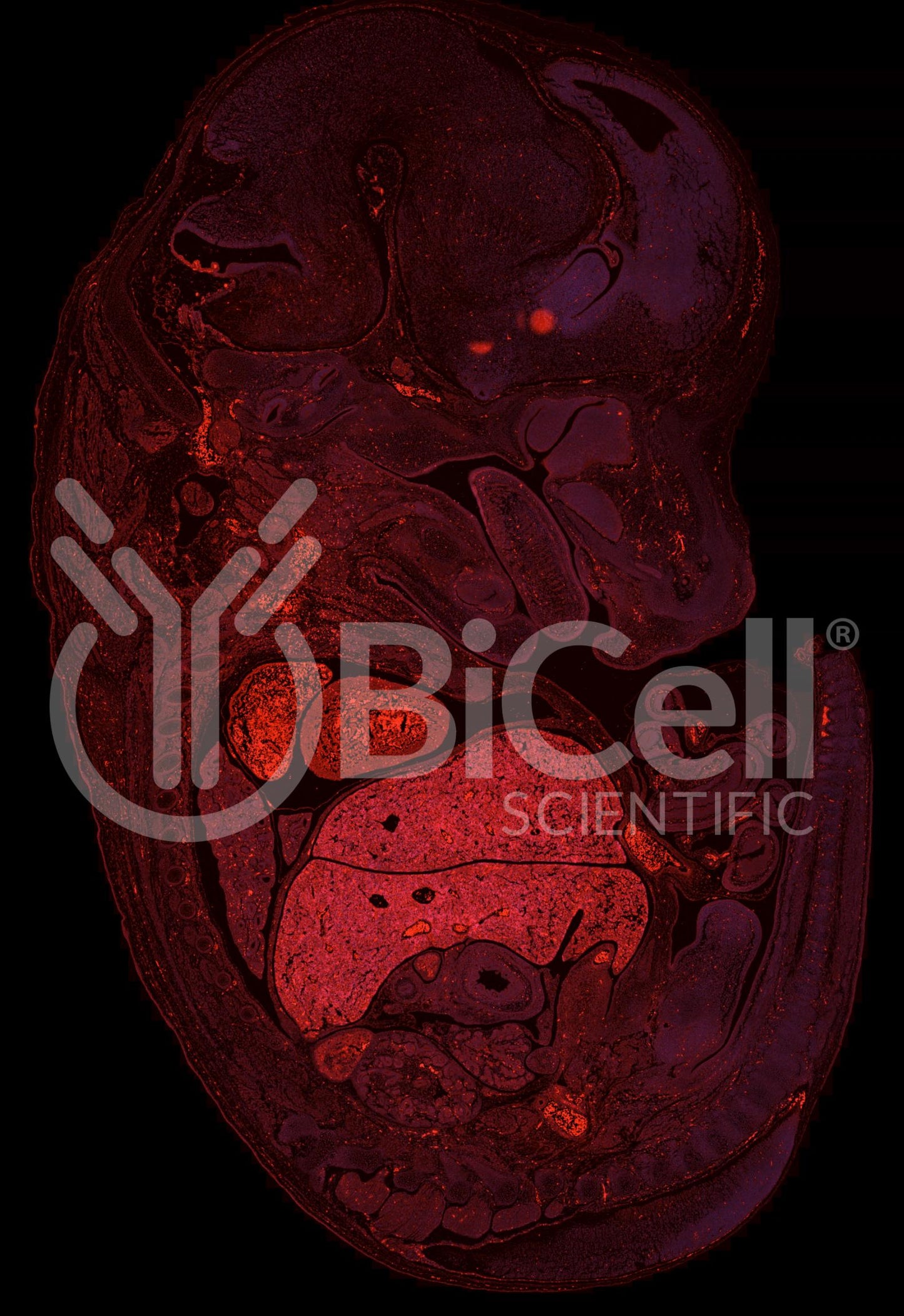 Integrin beta-4 (ITGB4 or CD104) Antibody - Western Blot Validated