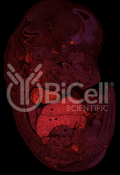 Integrin beta-4 (ITGB4 or CD104) Antibody - FFPE Validated