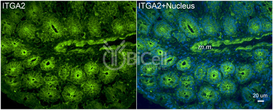 Integrin alpha-2 (ITGA2 or CD49b) Antibody - FFPE Validated
