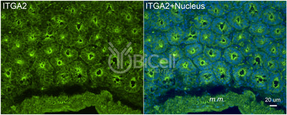 Integrin alpha-2 (ITGA2 or CD49b) Antibody - FFPE Validated