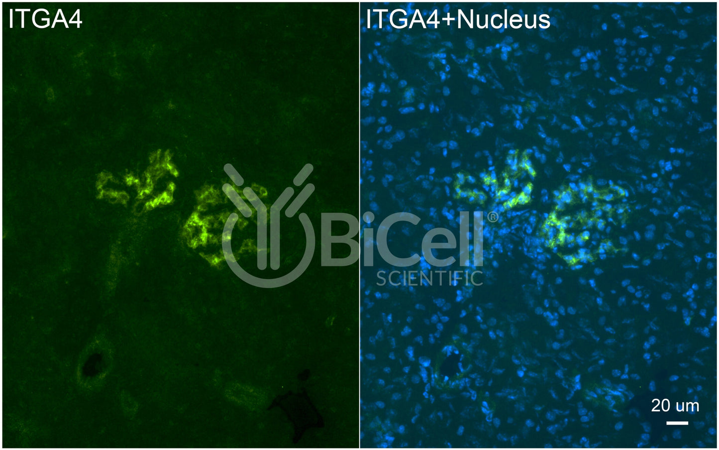 Integrin alpha-4 (ITGA4 or CD49d) Antibody - FFPE Validated