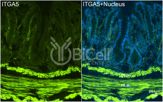 Integrin alpha-5 (ITGA5 or CD49e) Antibody - FFPE Validated