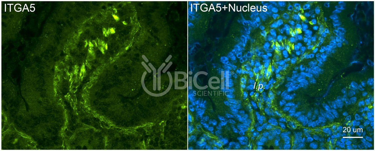 Integrin alpha-5 (ITGA5 or CD49e) Antibody - FFPE Validated