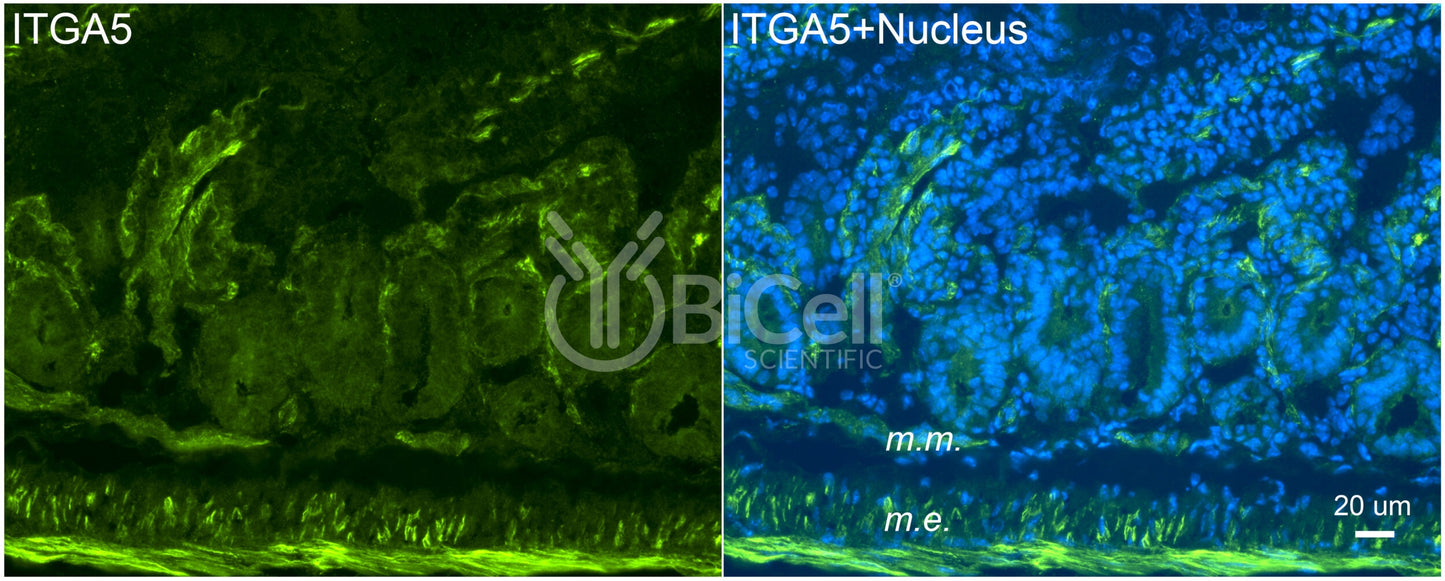 Integrin alpha-5 (ITGA5 or CD49e) Antibody - Western Blot Validated