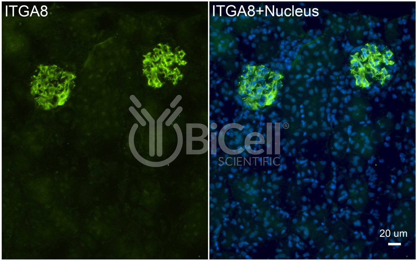 Integrin alpha-8 (ITGA8) Antibody - FFPE Validated