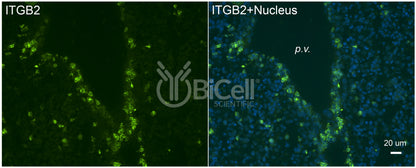 Integrin beta-2 (ITGB2 or CD18) Antibody - Western Blot Validated