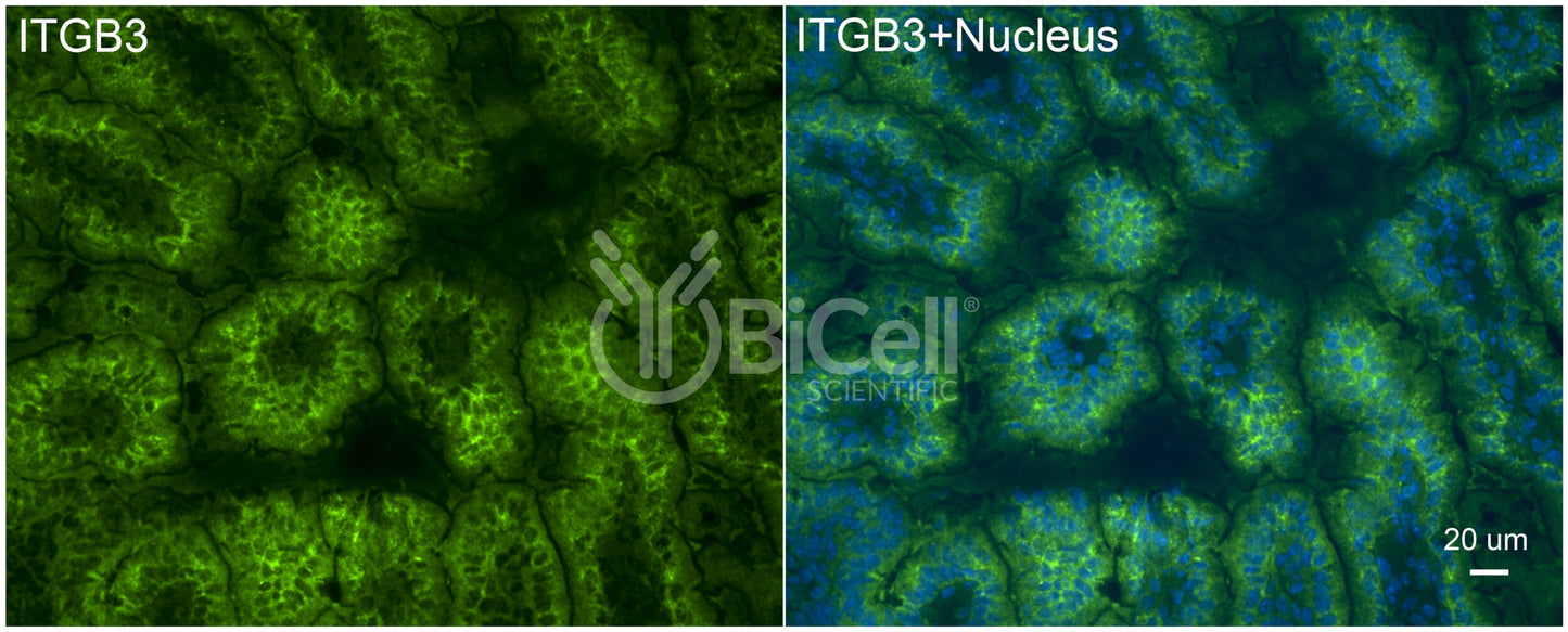 Integrin beta-3 (ITGB3 or CD61) Antibody - Western Blot Validated
