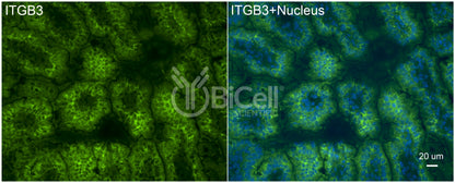 Integrin beta-3 (ITGB3 or CD61) Antibody