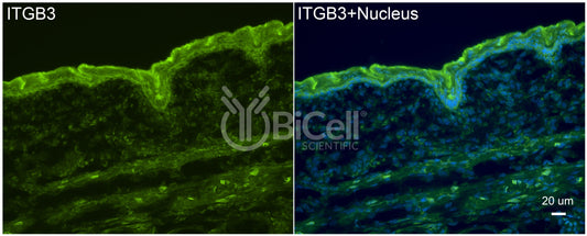 Integrin beta-3 (ITGB3 or CD61) Antibody