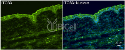 Integrin beta-3 (ITGB3 or CD61) Antibody - FFPE Validated