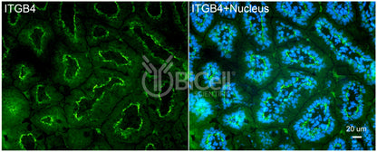 Integrin beta-4 (ITGB4 or CD104) Antibody - Western Blot Validated