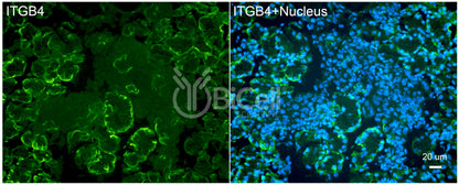 Integrin beta-4 (ITGB4 or CD104) Antibody - FFPE Validated