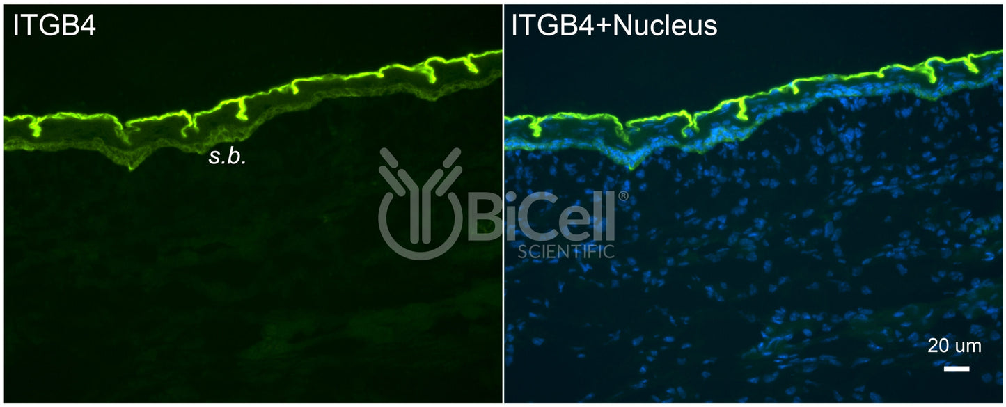 Integrin beta-4 (ITGB4 or CD104) Antibody - Western Blot Validated
