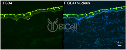 Integrin beta-4 (ITGB4 or CD104) Antibody - Western Blot Validated
