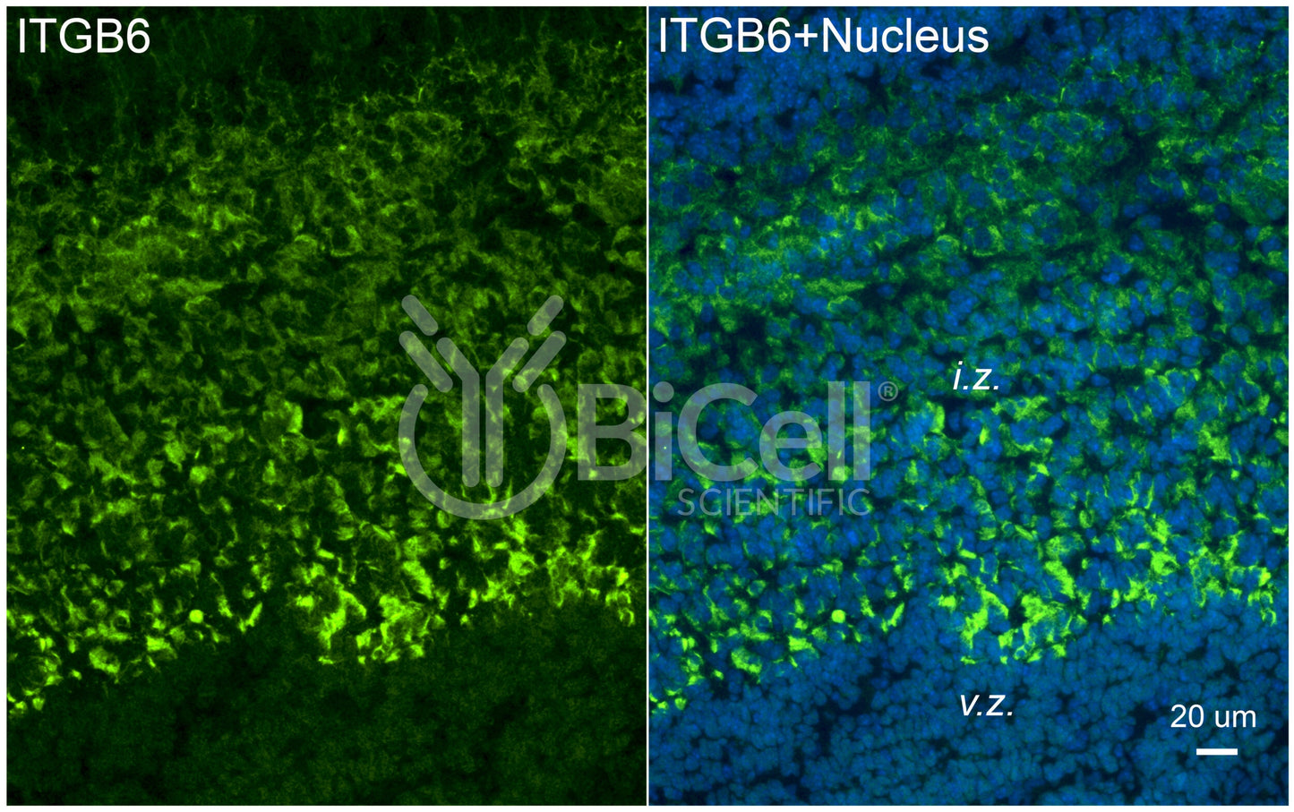 Integrin beta-6 (ITGB6) Antibody