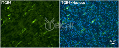 Integrin beta-6 (ITGB6) Antibody