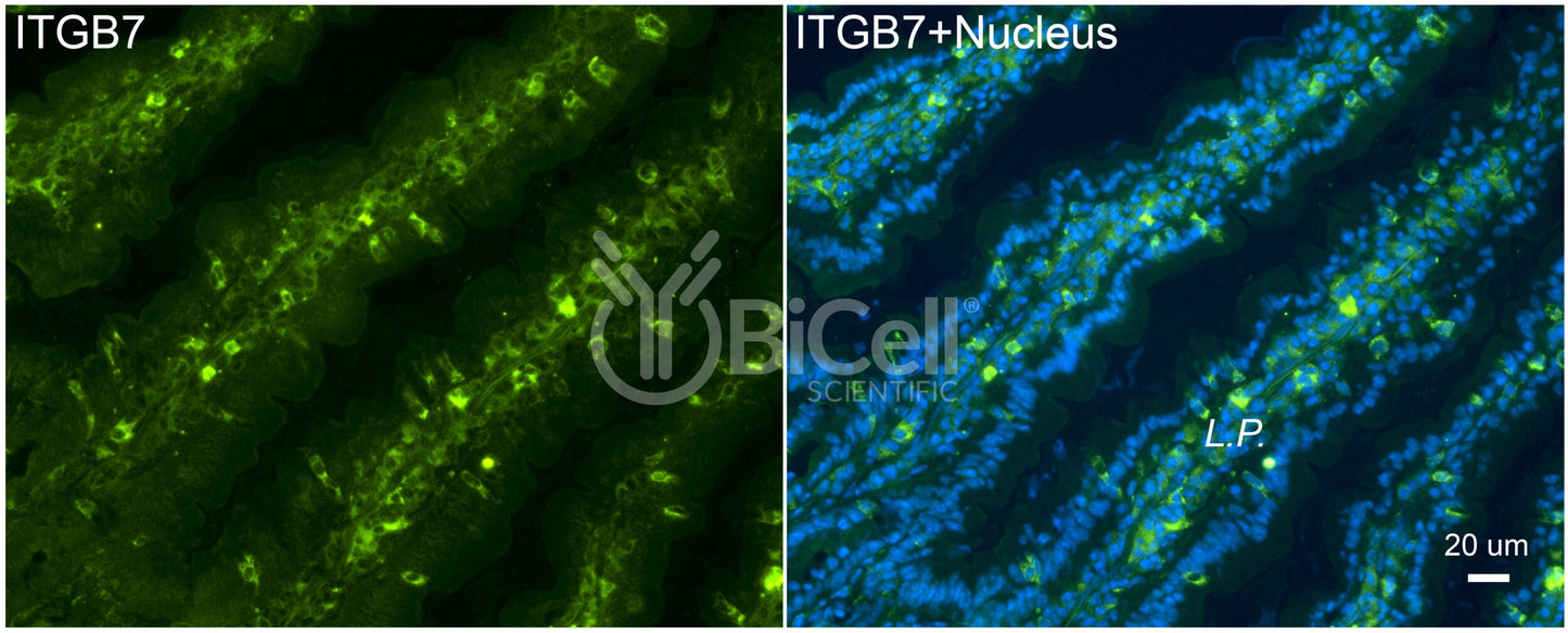 Integrin beta-7 (ITGB7) Antibody - FFPE Validated