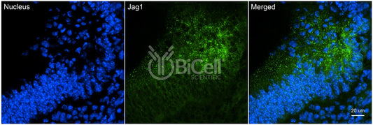 JAG1 (CD339) Antibody - Western Blot Validated
