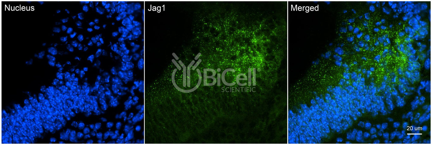 JAG1 (CD339) Antibody - FFPE Validated