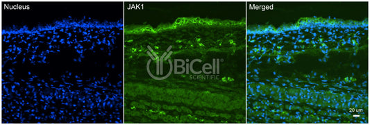JAK1 (JTK3) Antibody
