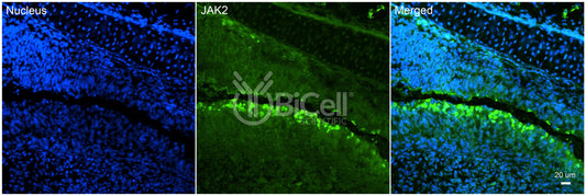 JAK2 (JTK10) Antibody - Western Blot Validated