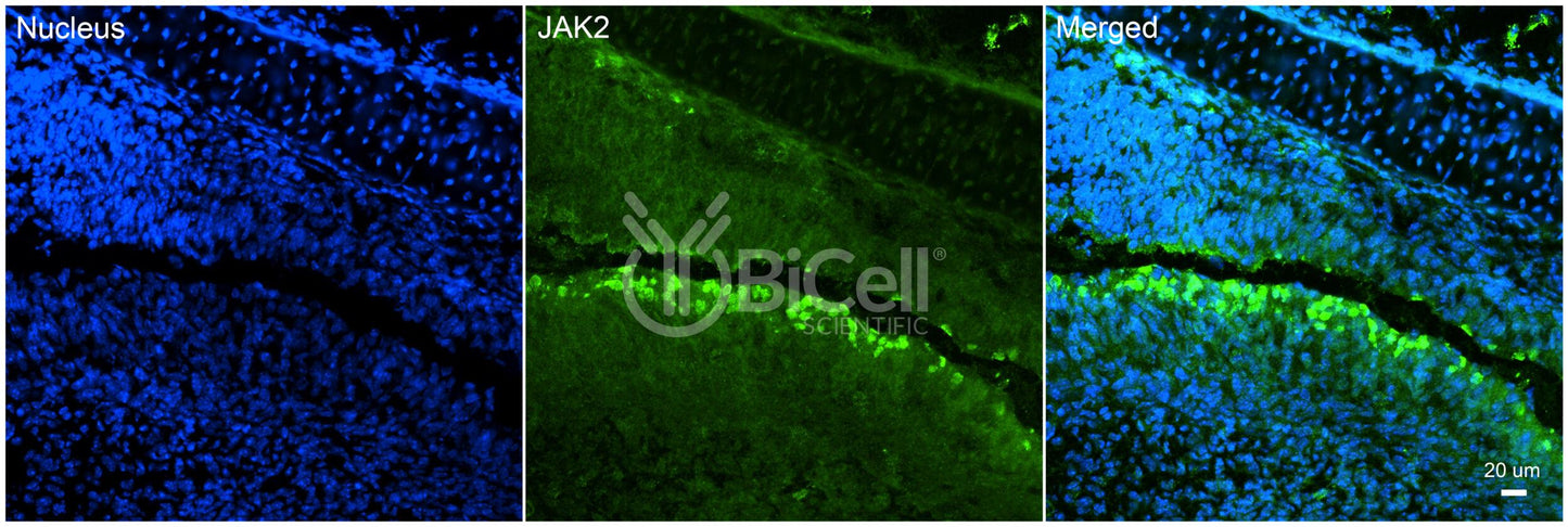 JAK2 (JTK10) Antibody