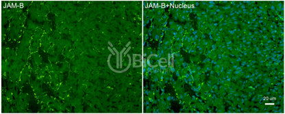 JAM-B (JAM2 or CD322) Antibody - FFPE Validated