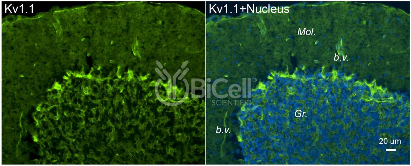 KCNA1 (Kv1.1) Antibody - FFPE Validated